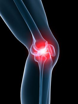 Improving outcomes for serious knee injuries