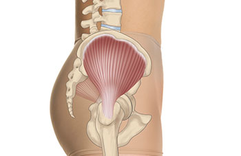 Open Hip Abductor Tendon Repair into a Bone Trough